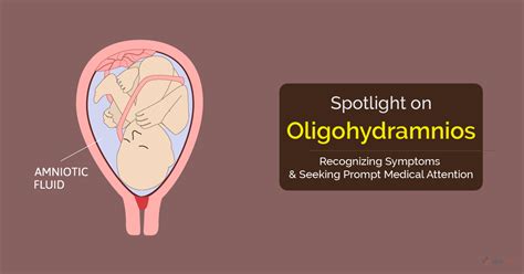 Oligohydramnios: Causes, Symptoms, Diagnosis & Treatment